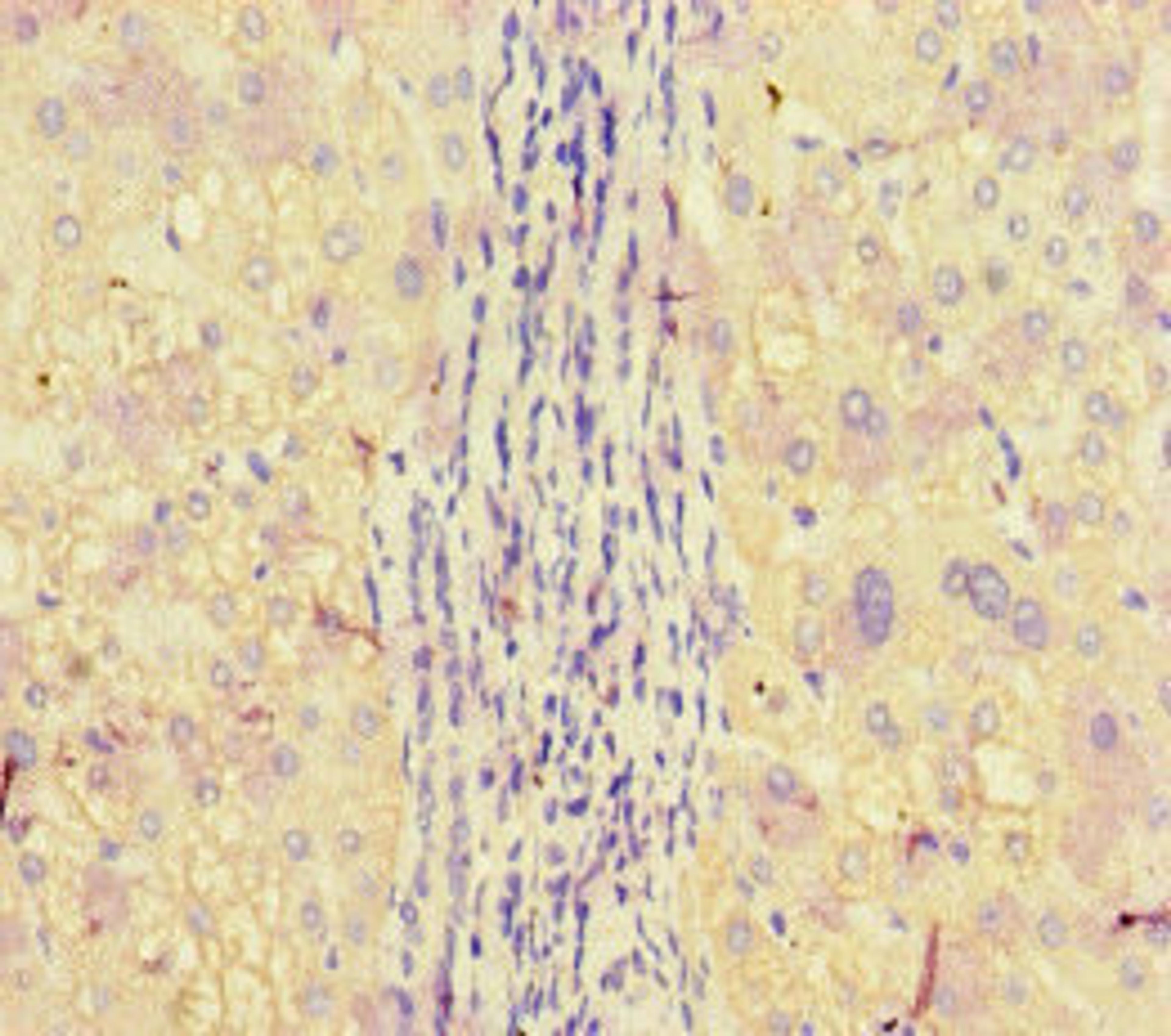Immunohistochemistry of paraffin-embedded human liver tissue using CSB-PA001926LA01HU at dilution of 1:100