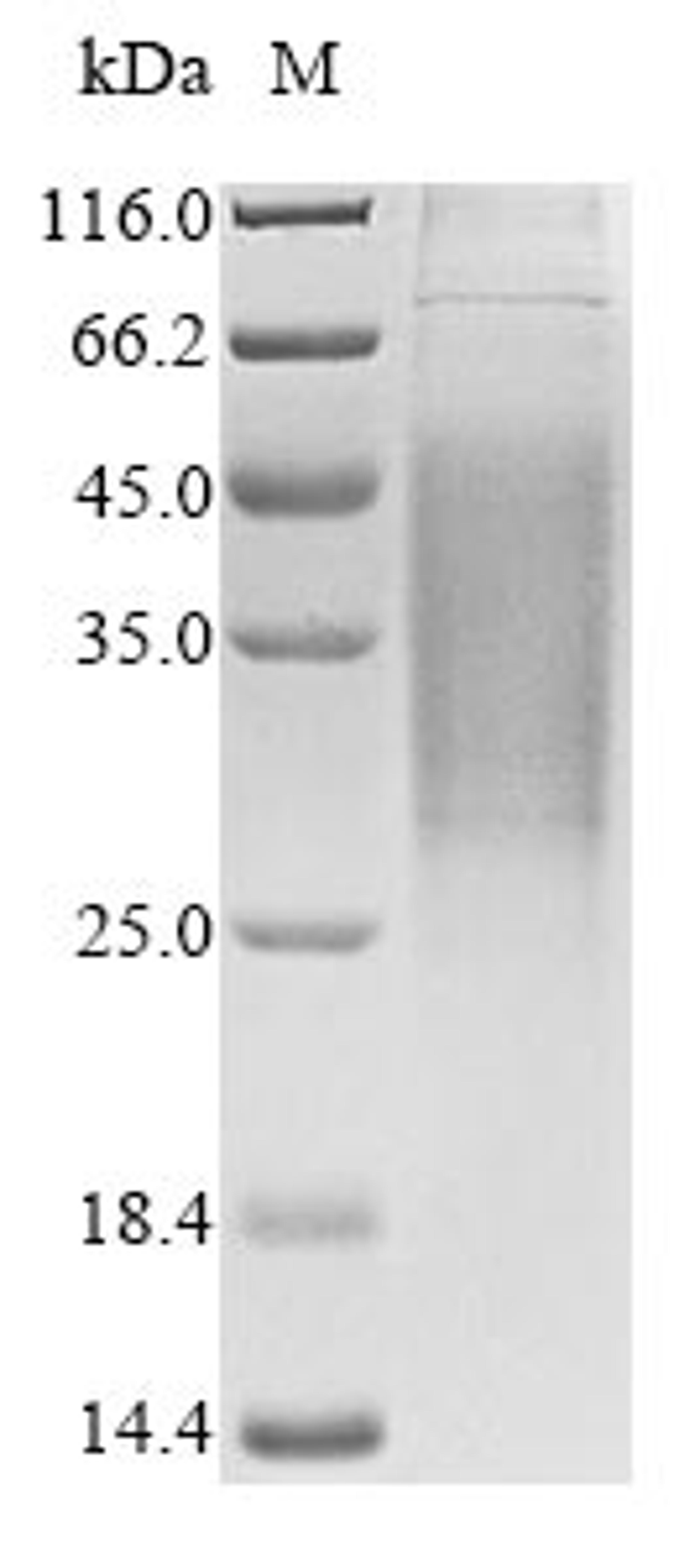 (Tris-Glycine gel) Discontinuous SDS-PAGE (reduced) with 5% enrichment gel and 15% separation gel.