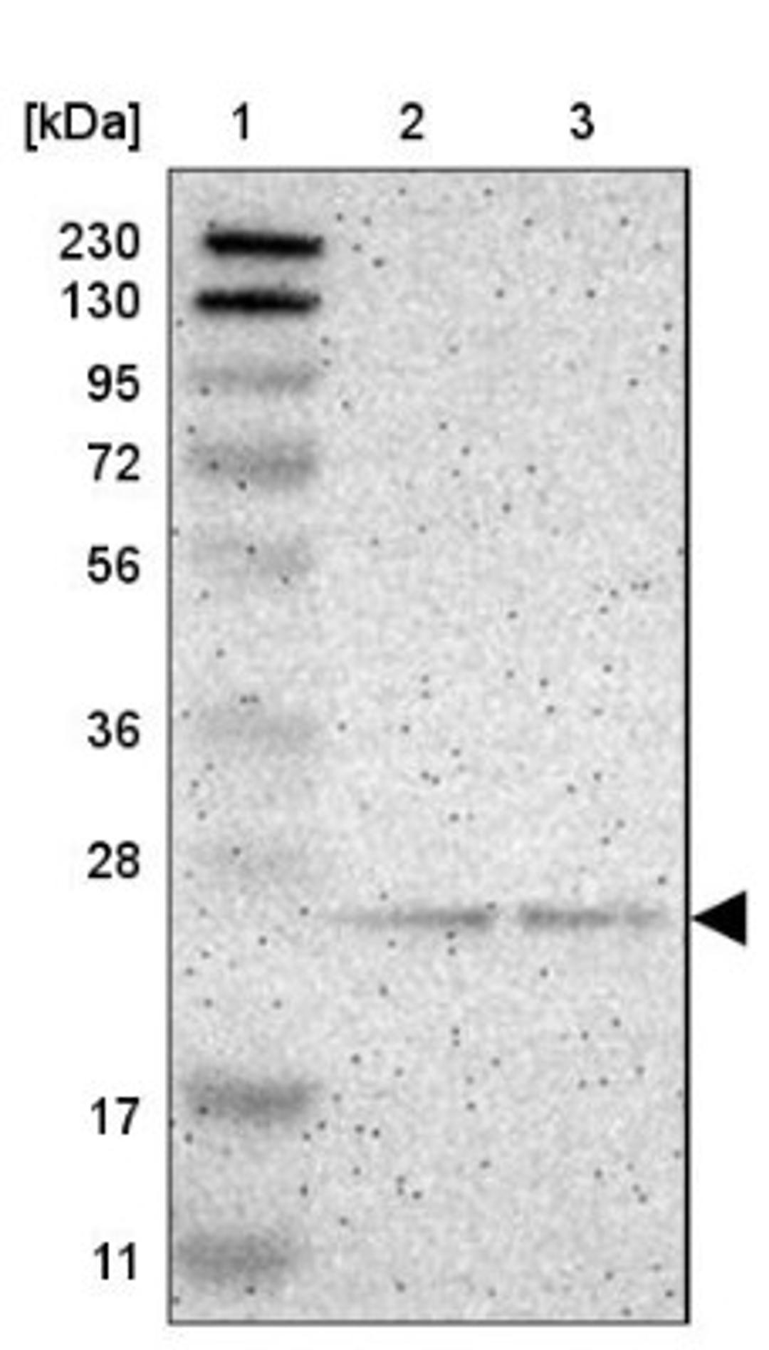 Western Blot: PDDC1 Antibody [NBP1-93843] - Lane 1: Marker [kDa] 230, 130, 95, 72, 56, 36, 28, 17, 11<br/>Lane 2: Human cell line RT-4<br/>Lane 3: Human cell line U-251MG sp