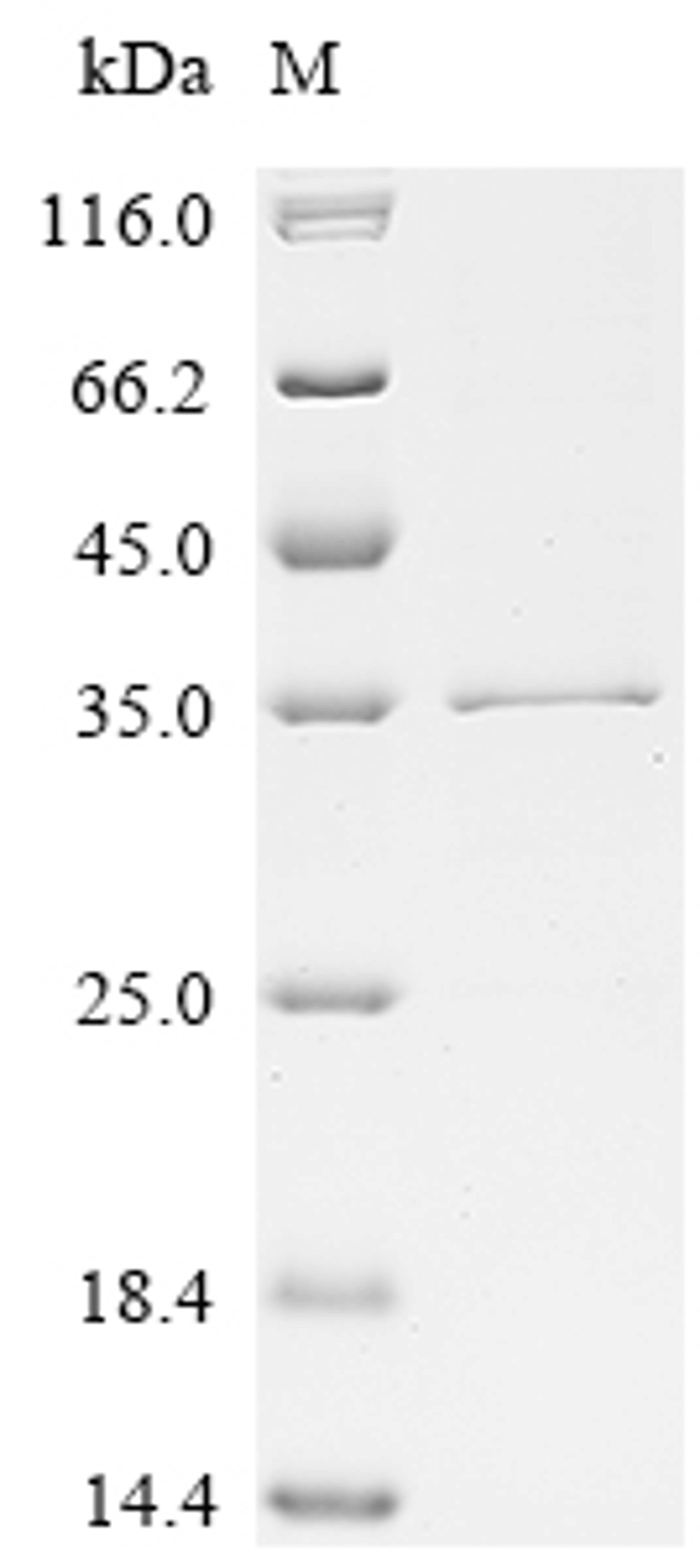 (Tris-Glycine gel) Discontinuous SDS-PAGE (reduced) with 5% enrichment gel and 15% separation gel.