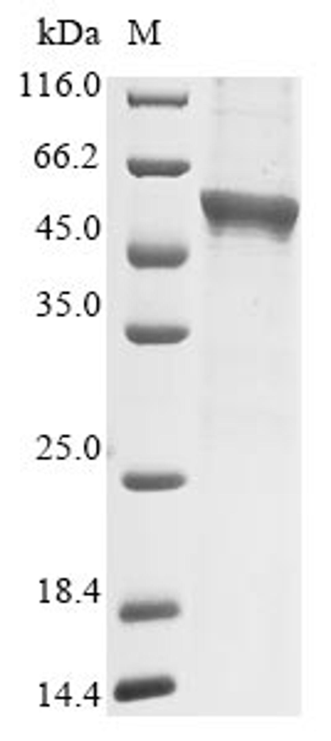 (Tris-Glycine gel) Discontinuous SDS-PAGE (reduced) with 5% enrichment gel and 15% separation gel.