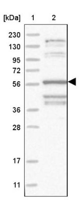 Western Blot: TAGAP Antibody [NBP1-88826] - Lane 1: Marker [kDa] 230, 130, 95, 72, 56, 36, 28, 17, 11<br/>Lane 2: Human cell line RT-4