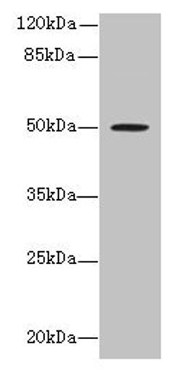 Western blot. All lanes: RUNDC3A antibody at 1.5µg/ml + MCF-7 whole cell lysate. Secondary. Goat polyclonal to rabbit IgG at 1/10000 dilution. Predicted band size: 50, 46, 42 kDa. Observed band size: 50 kDa