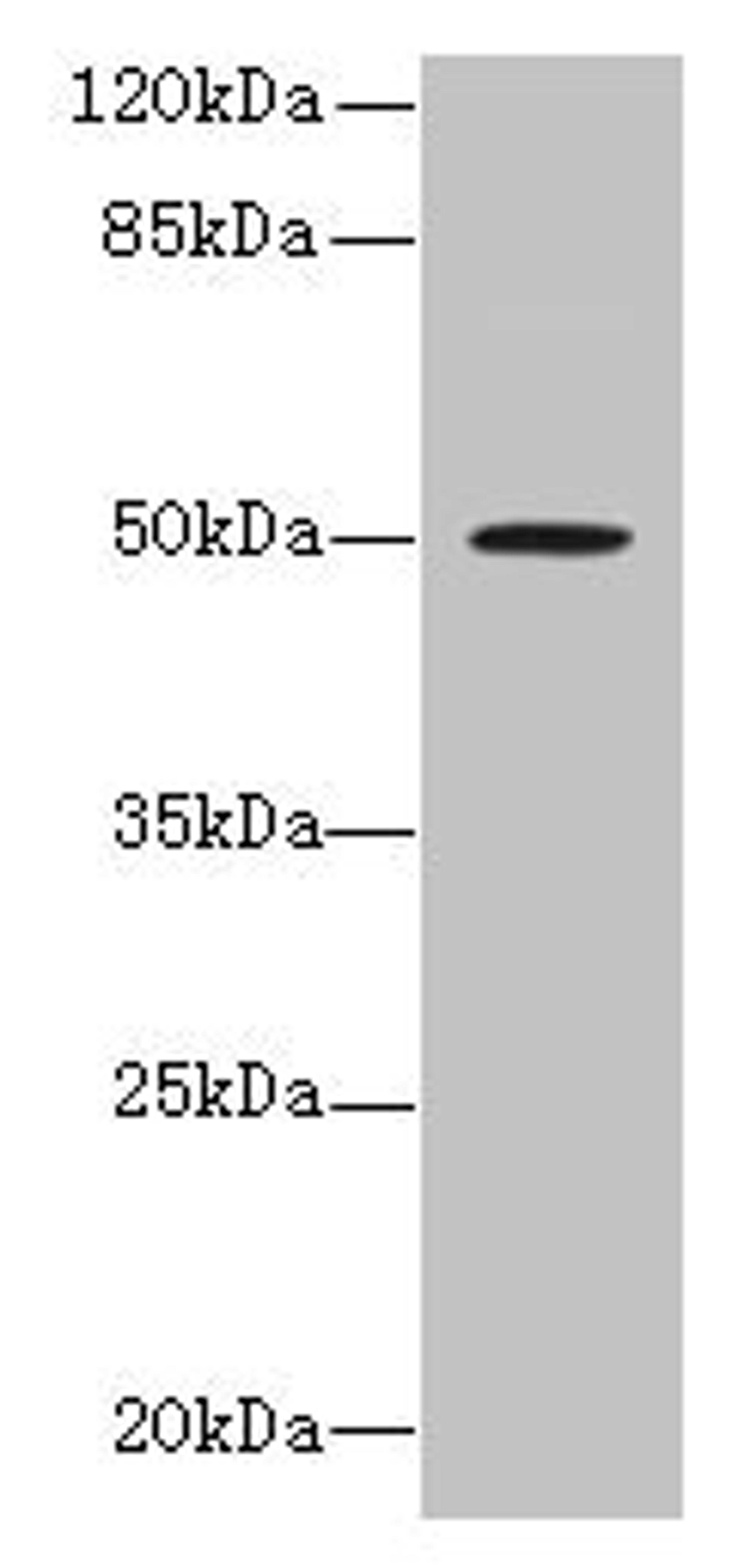 Western blot. All lanes: RUNDC3A antibody at 1.5µg/ml + MCF-7 whole cell lysate. Secondary. Goat polyclonal to rabbit IgG at 1/10000 dilution. Predicted band size: 50, 46, 42 kDa. Observed band size: 50 kDa