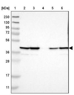 Western Blot: UBXN1 Antibody [NBP1-89387] - Lane 1: Marker [kDa] 230, 130, 95, 72, 56, 36, 28, 17, 11<br/>Lane 2: Human cell line RT-4<br/>Lane 3: Human cell line U-251MG sp<br/>Lane 4: Human plasma (IgG/HSA depleted)<br/>Lane 5: Human liver tissue<br/>Lane 6: Human tonsil tissue