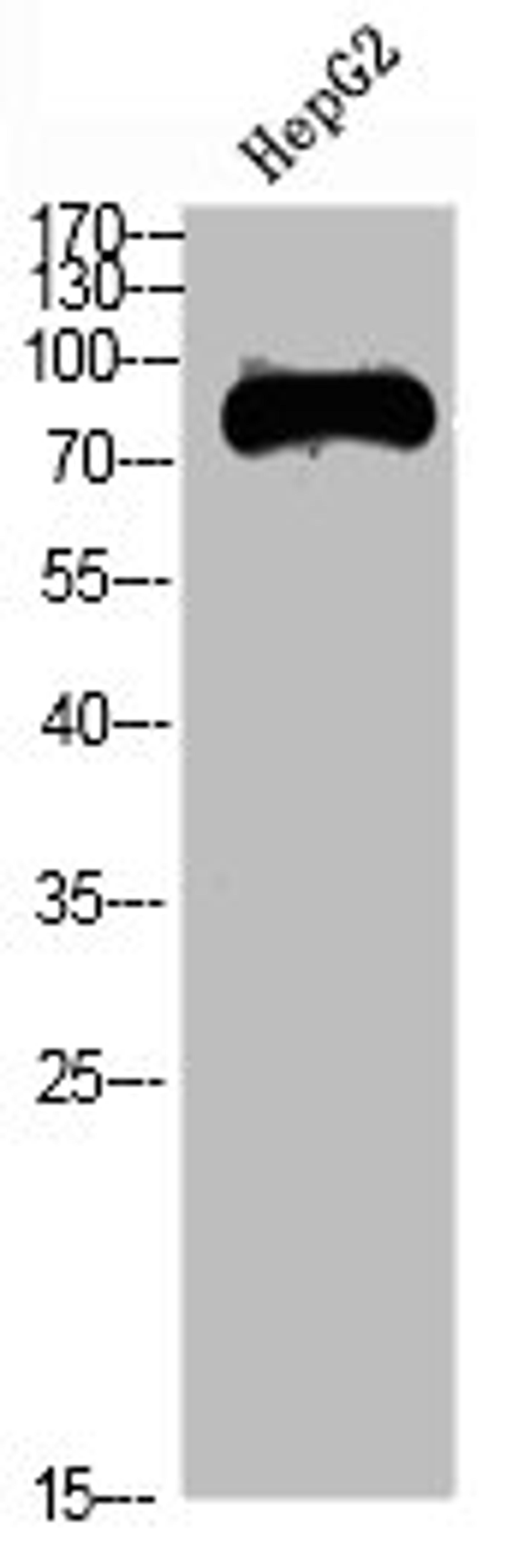 Western Blot analysis of HEPG2 cells using TRIF Polyclonal Antibody diluted at 1:1000. Secondary antibody was diluted at 1:20000