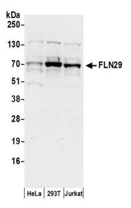 Detection of human FLN29 by western blot.