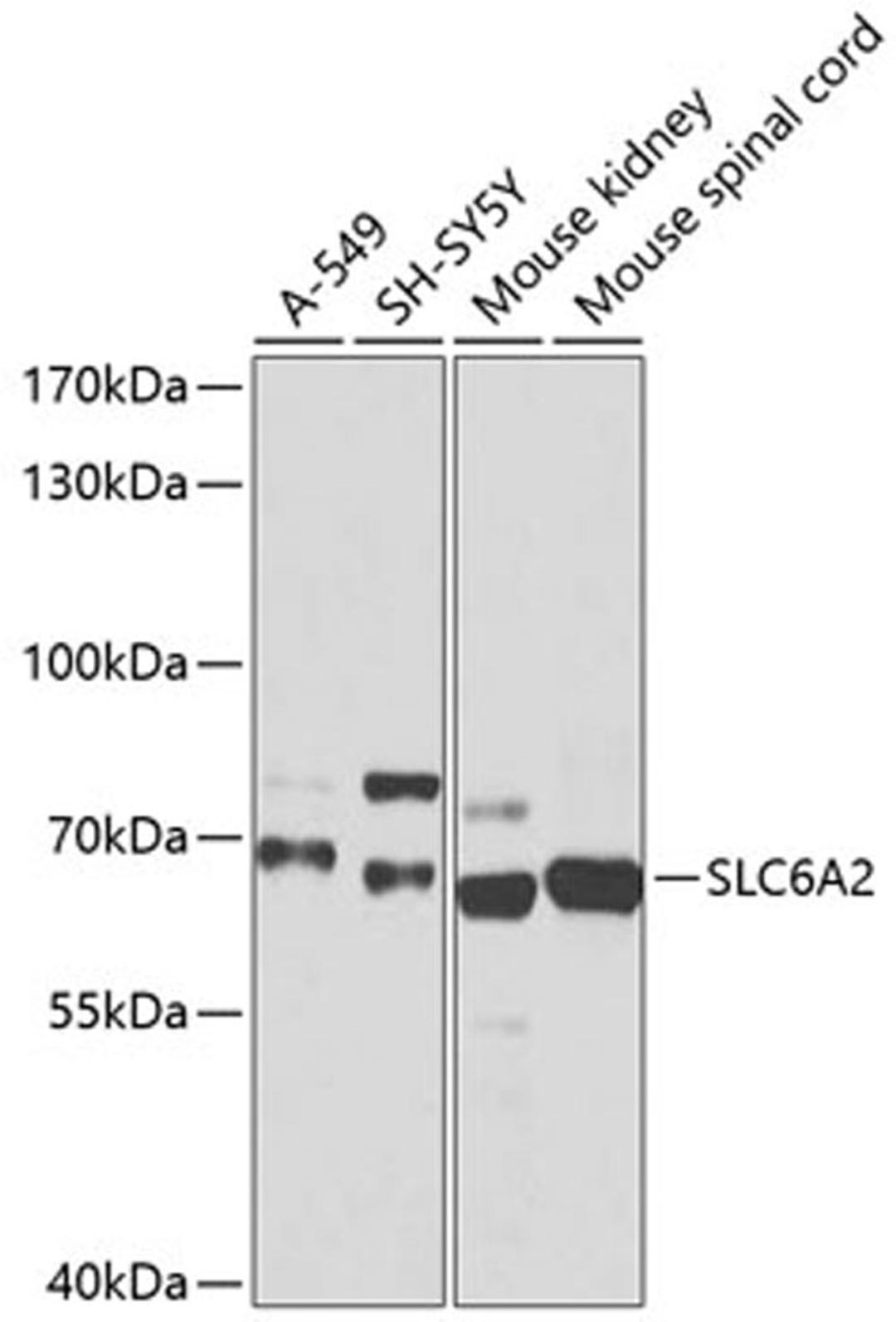 Western blot - SLC6A2 antibody (A1421)