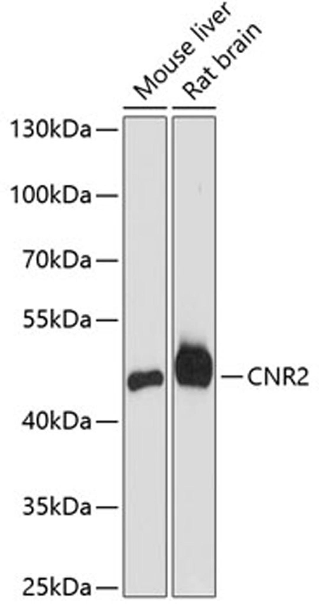 Western blot - CNR2 antibody (A1762)