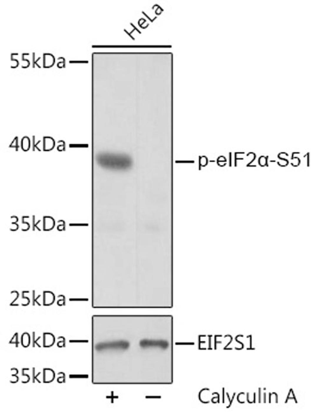 Western blot - Phospho-eIF2a-S51 pAb (AP0745)