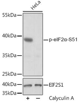 Western blot - Phospho-eIF2a-S51 pAb (AP0745)