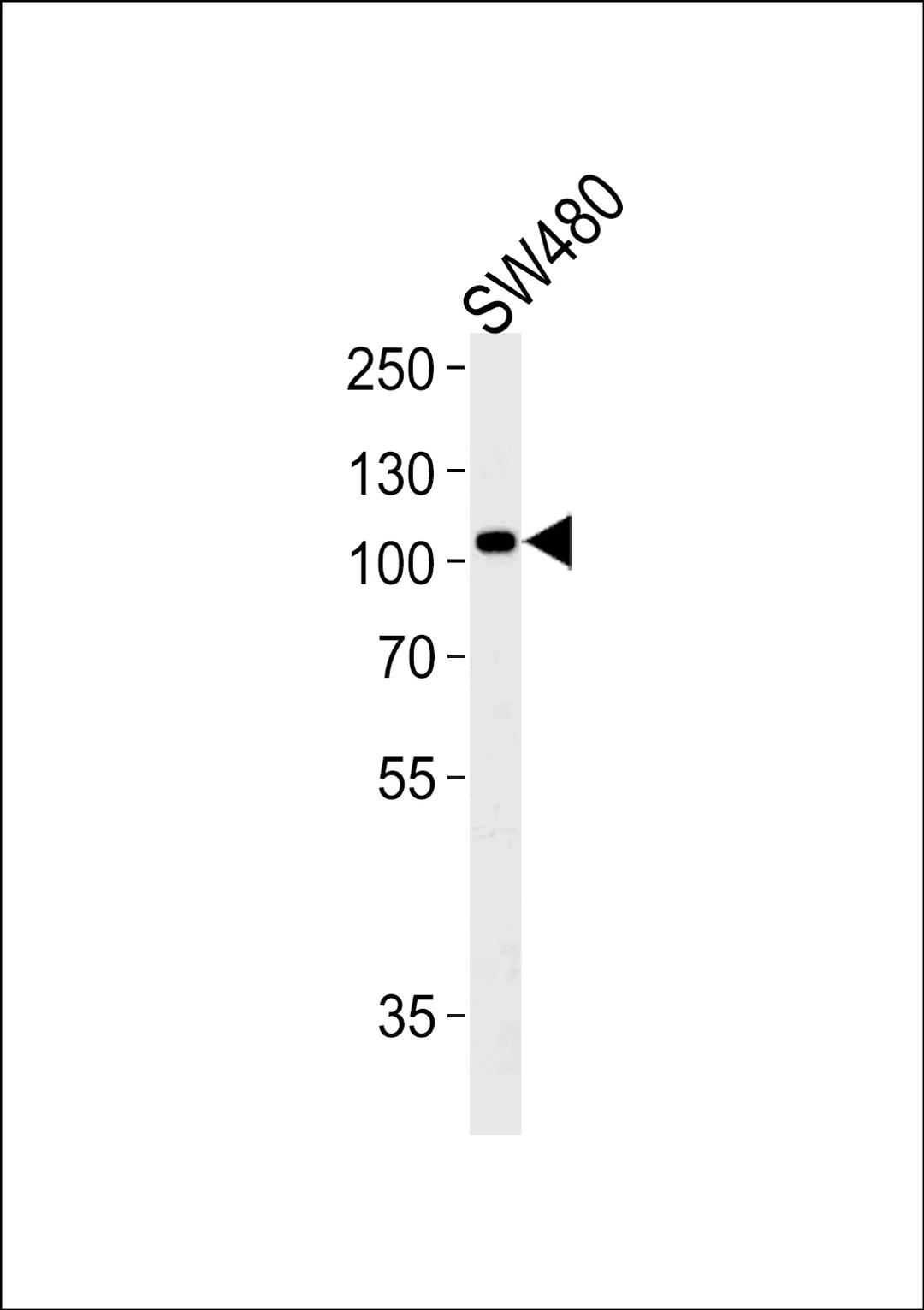 Western blot analysis of lysate from SW480 cell line,using LRP12 Antibody at 1:1000 at each lane