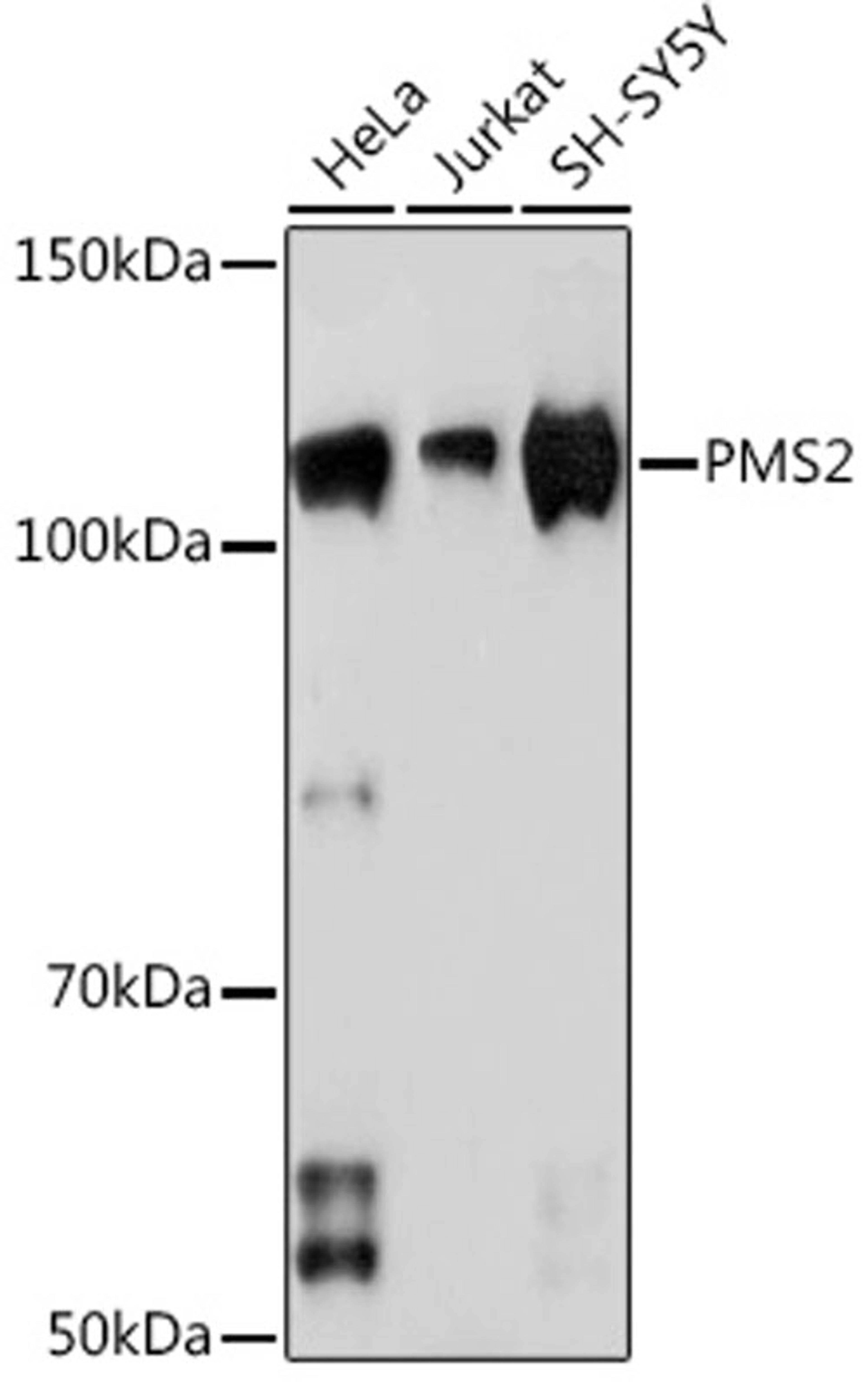 Western blot - PMS2 Rabbit mAb (A4577)