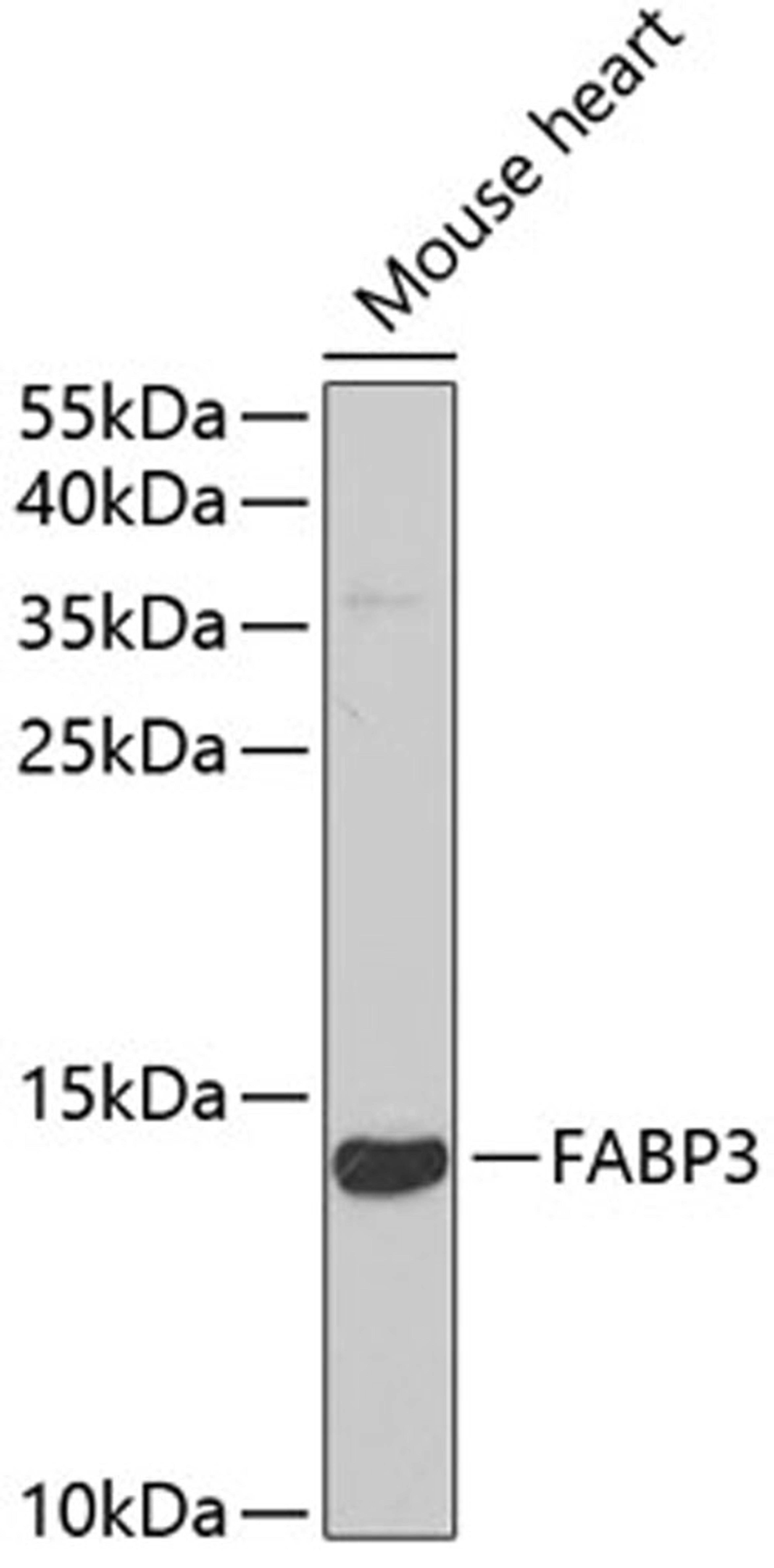 Western blot - FABP3 antibody (A5312)