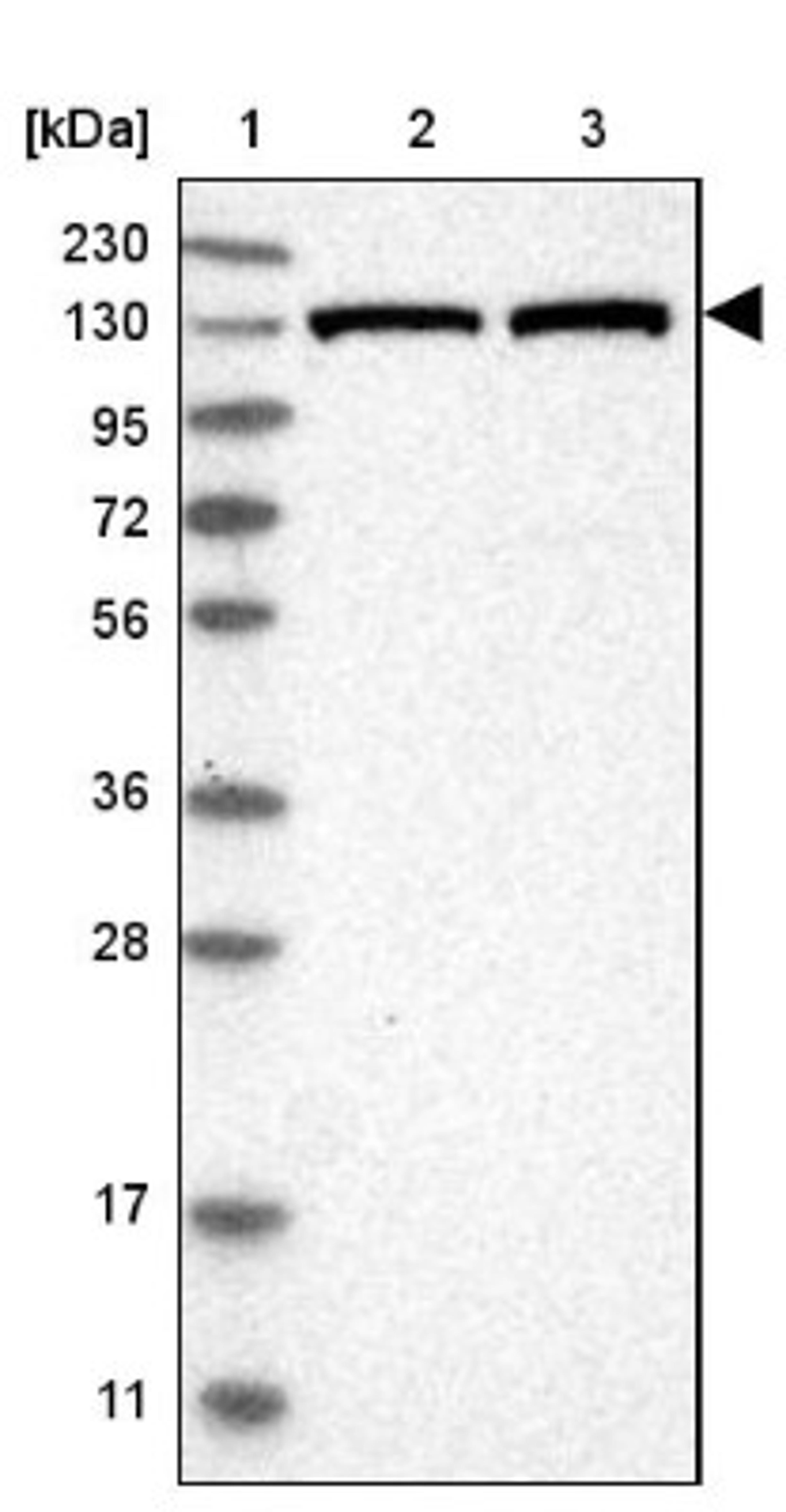 Western Blot: Exportin-5 Antibody [NBP1-89605] - Lane 1: Marker [kDa] 230, 130, 95, 72, 56, 36, 28, 17, 11<br/>Lane 2: Human cell line RT-4<br/>Lane 3: Human cell line U-251MG sp