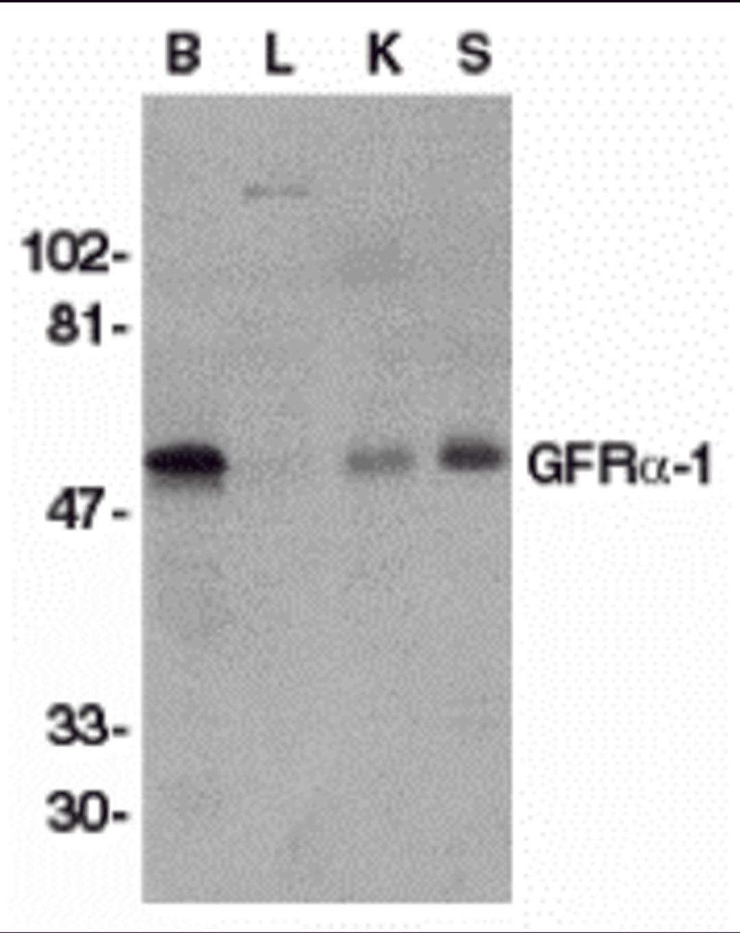Western blot analysis of GFR alpha 1 in crude membrane fractions of human brain (B), liver (L), kidney (K), and spleen (S), respectively, with GFR alpha 1 antibody at 1 μg/mL.