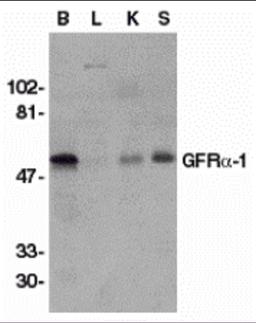 Western blot analysis of GFR alpha 1 in crude membrane fractions of human brain (B), liver (L), kidney (K), and spleen (S), respectively, with GFR alpha 1 antibody at 1 μg/mL.