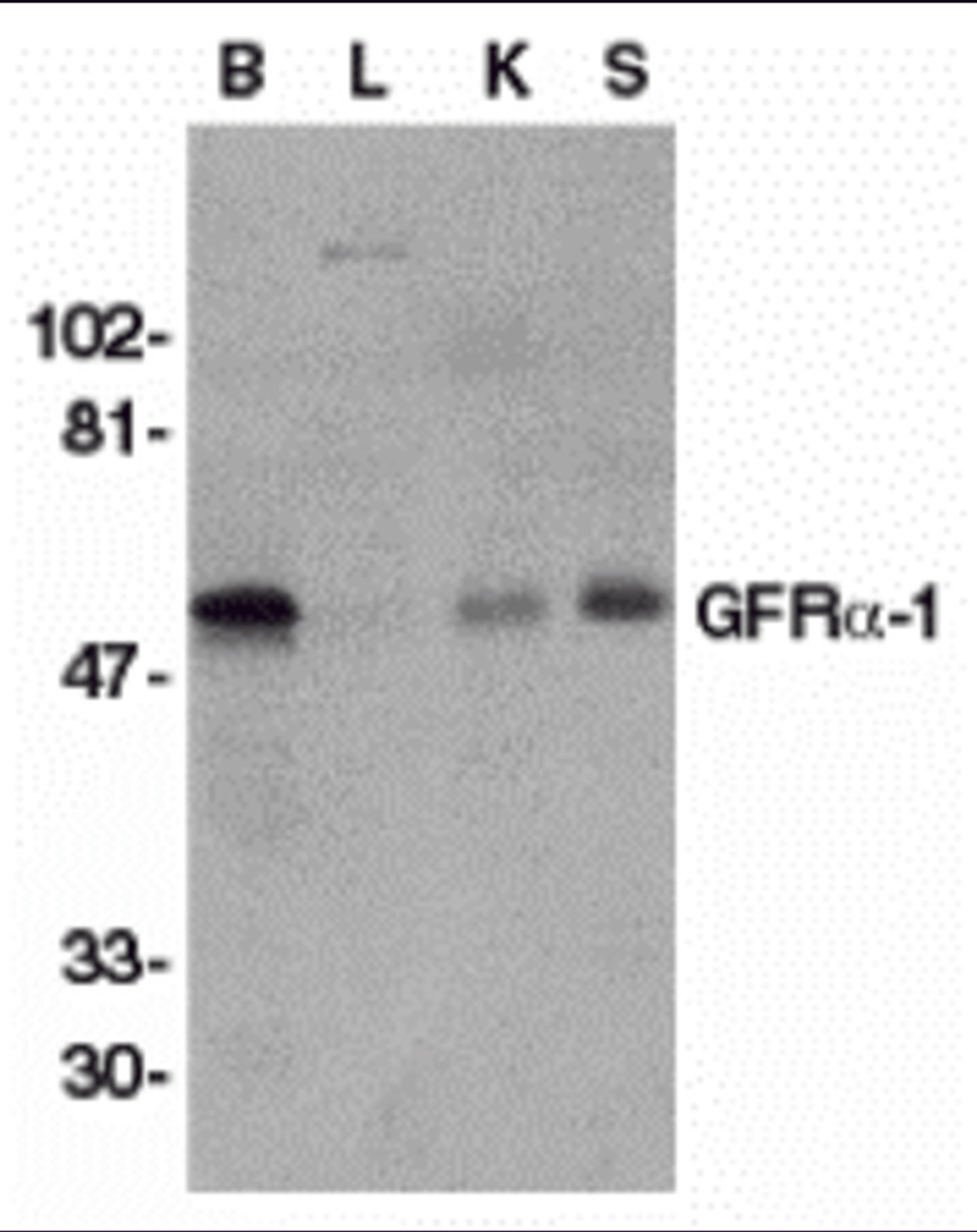 Western blot analysis of GFR alpha 1 in crude membrane fractions of human brain (B), liver (L), kidney (K), and spleen (S), respectively, with GFR alpha 1 antibody at 1 μg/mL.