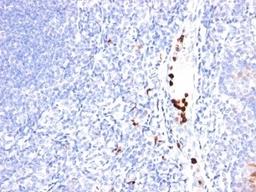 Formalin-fixed, paraffin-embedded human tonsil stained with GCSF antibody (SPM468).