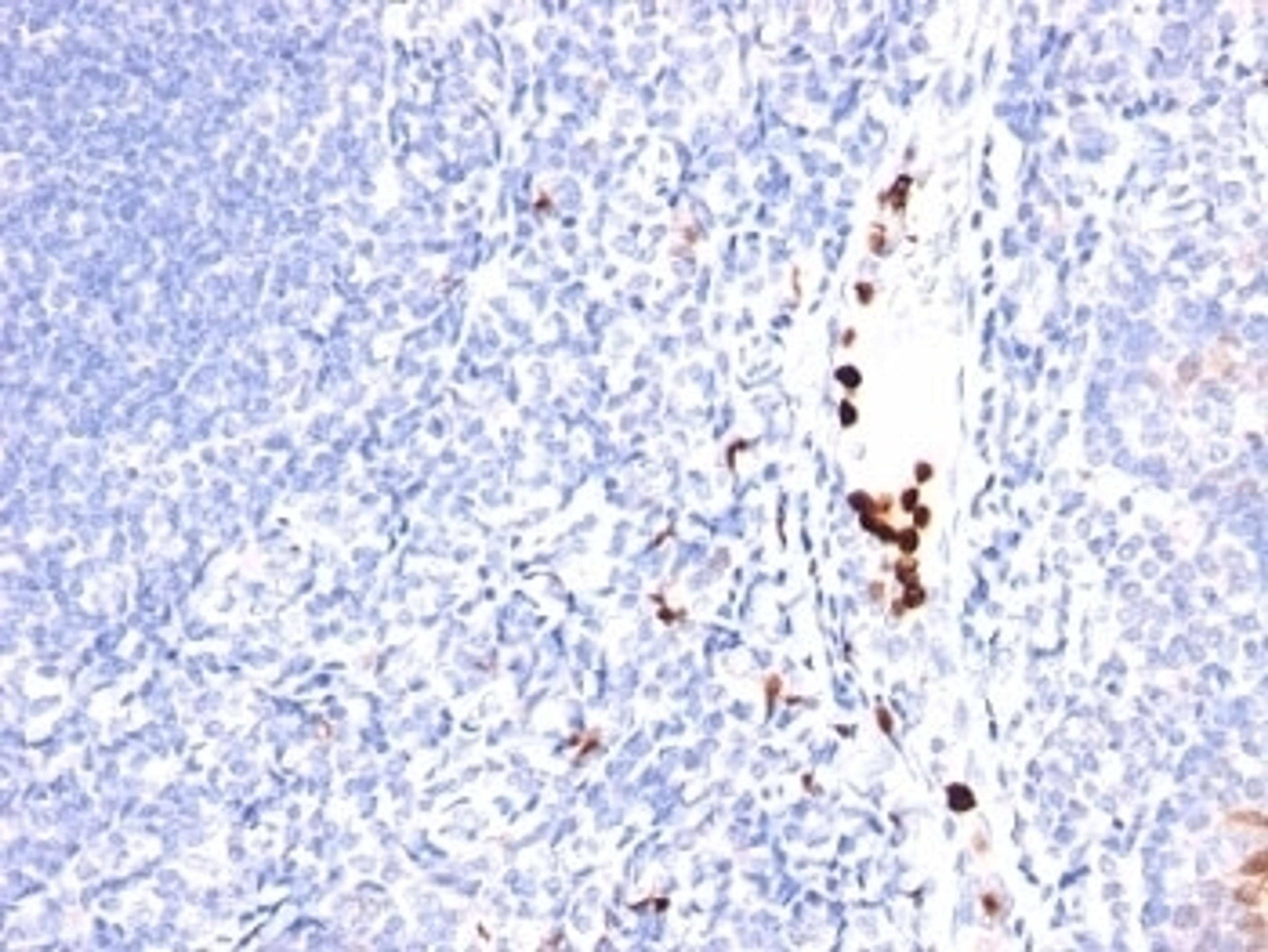 Formalin-fixed, paraffin-embedded human tonsil stained with GCSF antibody (SPM468).