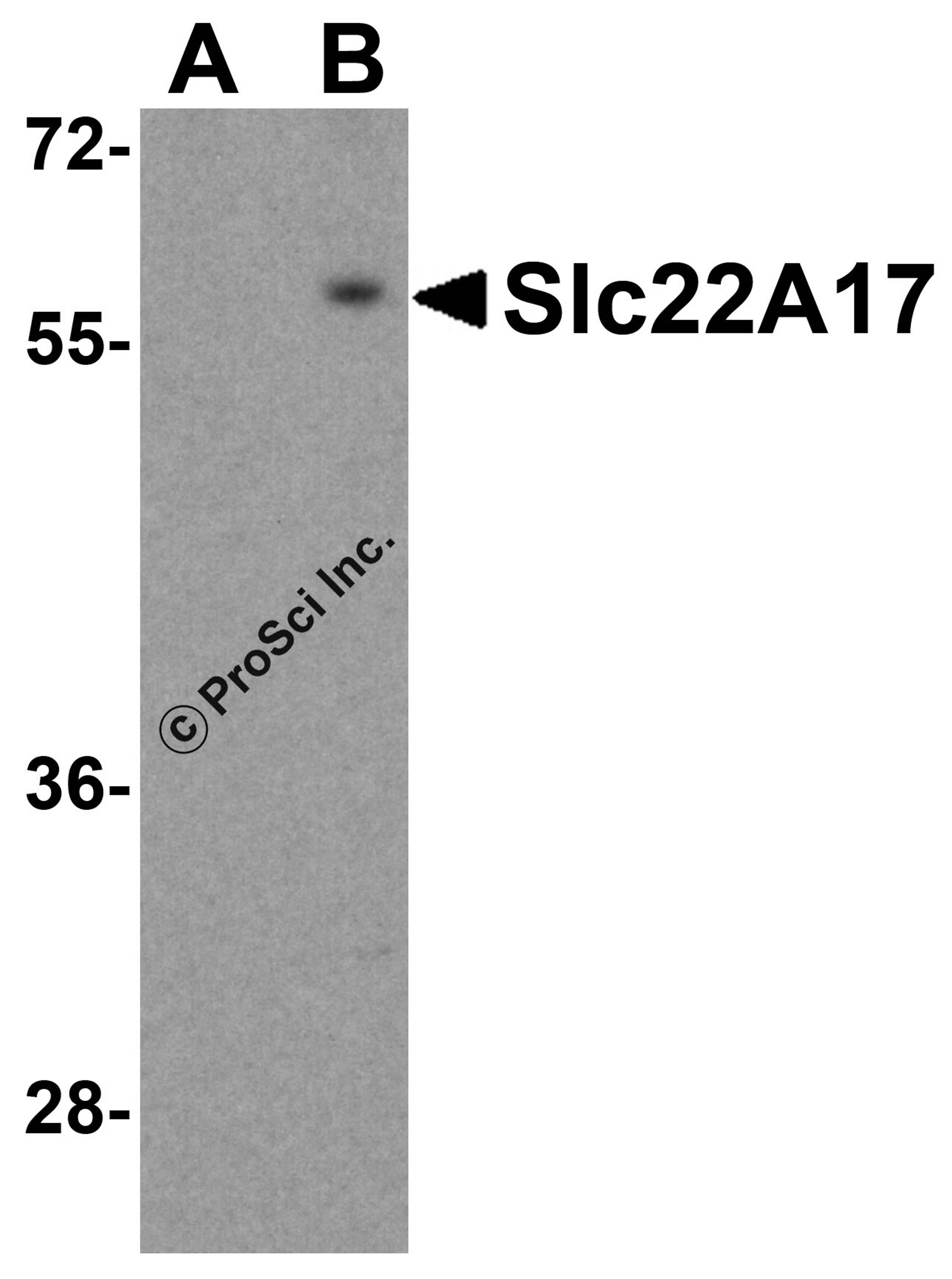Western blot analysis of Slc22A17 in SK-N-SH lysate with Slc22A17 antibody at 0.5 μg/mL in (A) the presence and (B) the absence of blocking peptide.