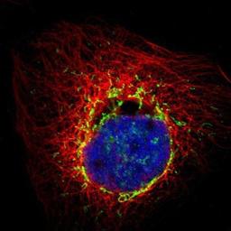 Immunocytochemistry/Immunofluorescence: PMPCA Antibody [NBP1-89126] - Staining of human cell line A-431 shows positivity in mitochondria.