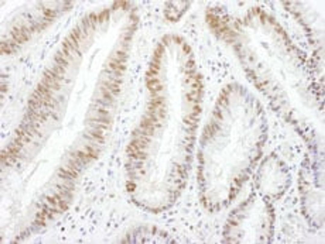 Detection of human BRG1 by immunohistochemistry.