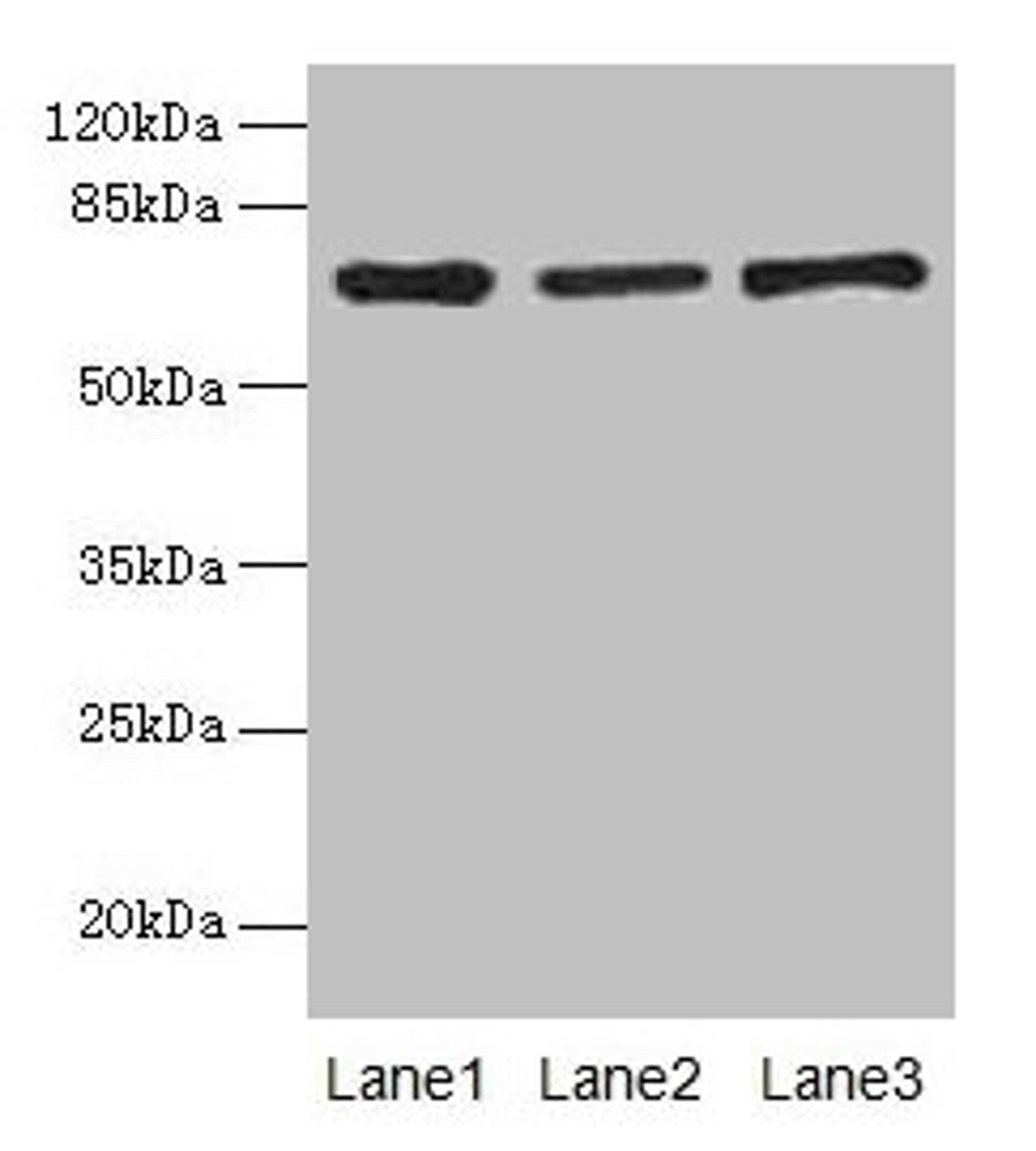 Western blot. All lanes: Afp antibody at 10µg/ml. Lane 1: HepG2 whole cell lysate. Lane 2: Rat liver tissue. Lane 3: 293T whole cell lysate. Secondary. Goat polyclonal to rabbit IgG at 1/10000 dilution. Predicted band size: 68 kDa. Observed band size: 68 kDa