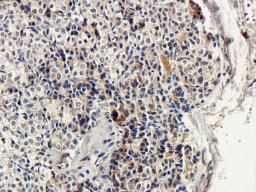 Immunohistochemical staining of paraffin embedded rat thyroid tissue using anti-Syndecan 2 (2.5 ug/ml)