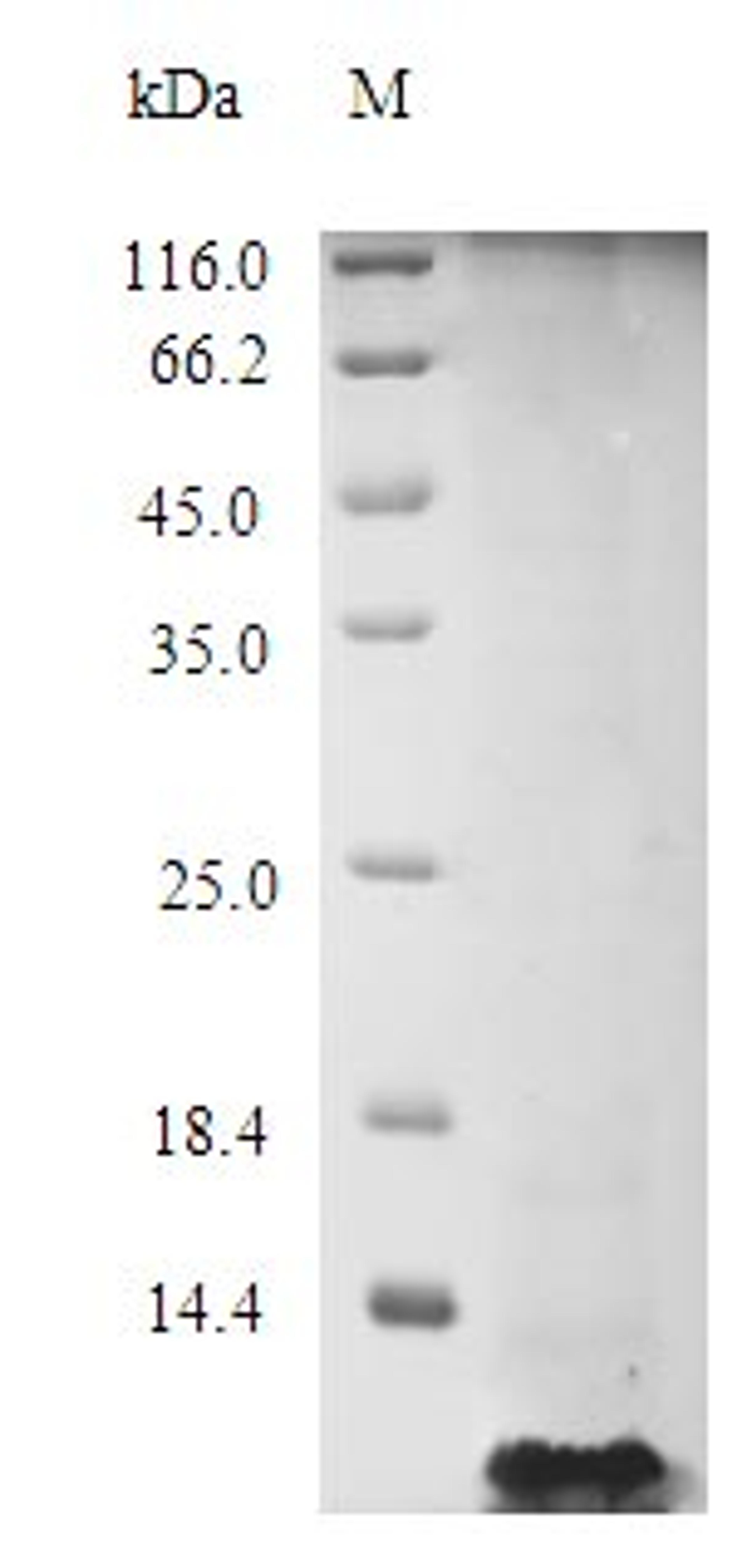 (Tris-Glycine gel) Discontinuous SDS-PAGE (reduced) with 5% enrichment gel and 15% separation gel.