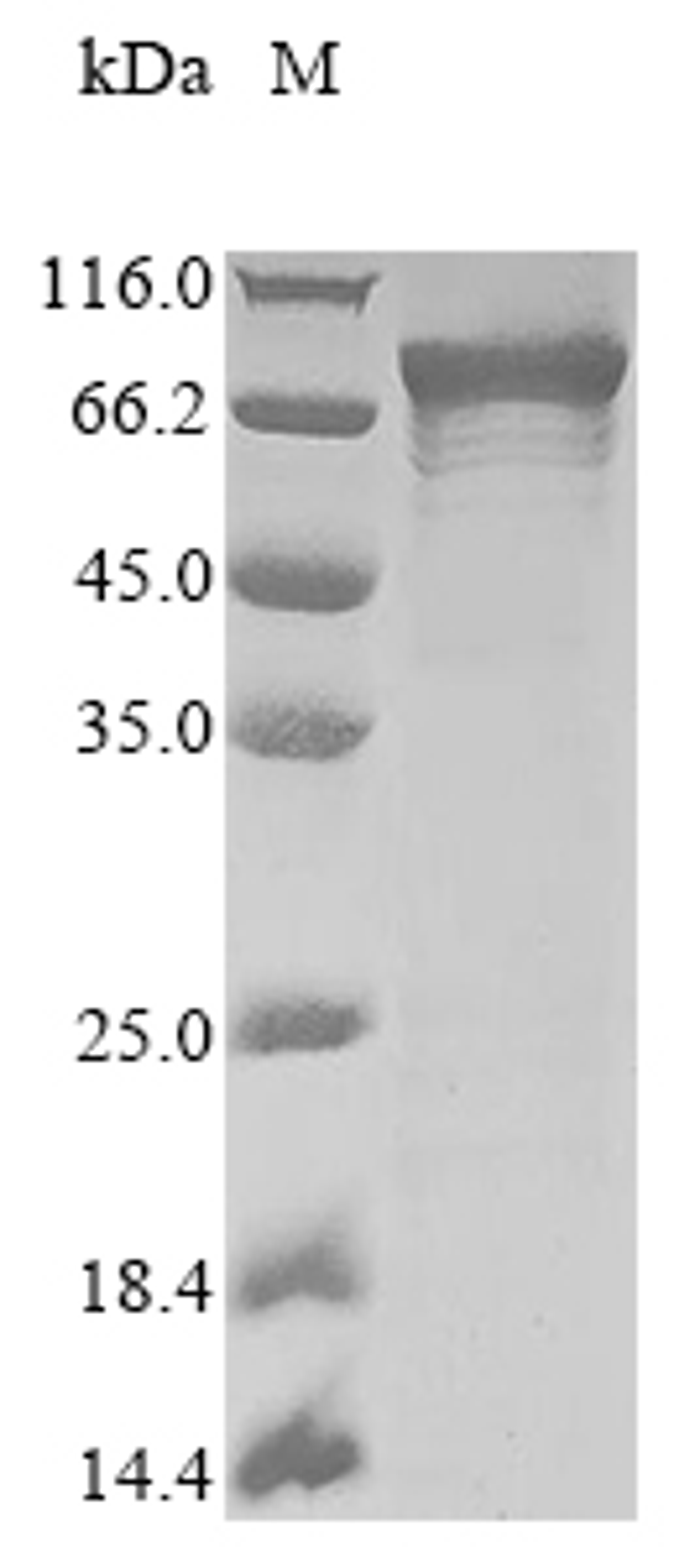 (Tris-Glycine gel) Discontinuous SDS-PAGE (reduced) with 5% enrichment gel and 15% separation gel.