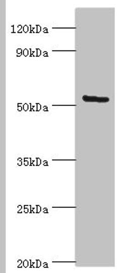Western blot. All lanes: ALG1 antibody at 10ug/ml + Hela whole cell lysate. Secondary. Goat polyclonal to rabbit IgG at 1/10000 dilution. Predicted band size: 53, 41 kDa. Observed band size: 53 kDa. 