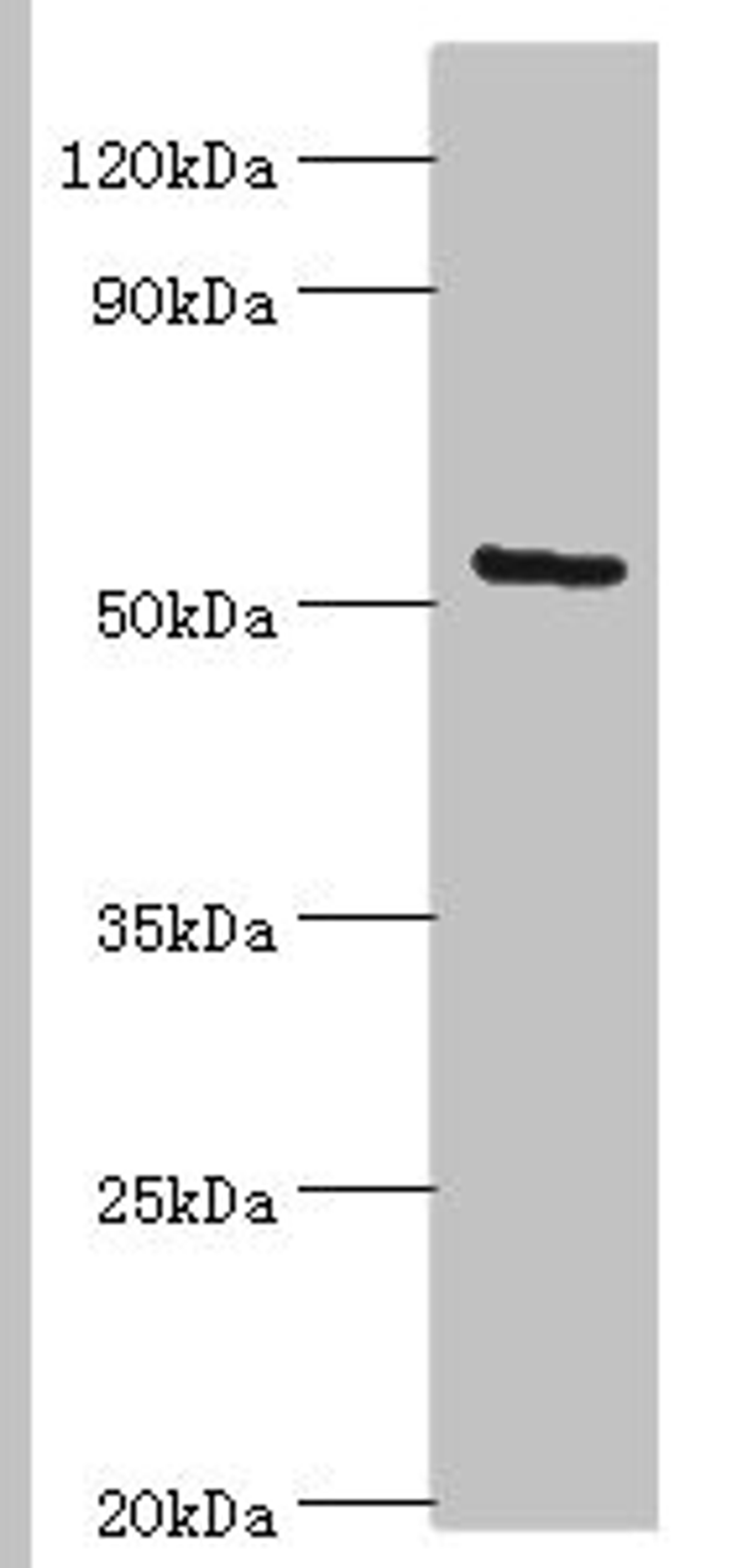 Western blot. All lanes: ALG1 antibody at 10ug/ml + Hela whole cell lysate. Secondary. Goat polyclonal to rabbit IgG at 1/10000 dilution. Predicted band size: 53, 41 kDa. Observed band size: 53 kDa. 