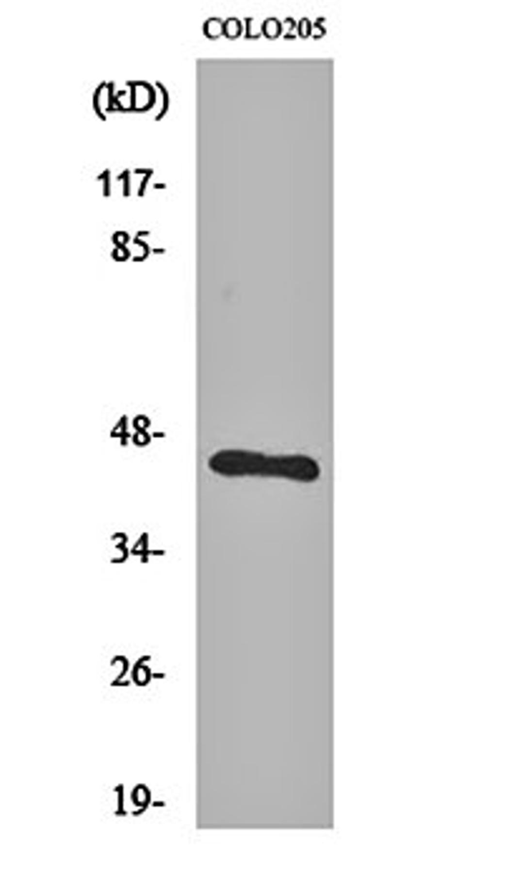 Western blot analysis of COLO205 cell lysates using BMP-8A antibody