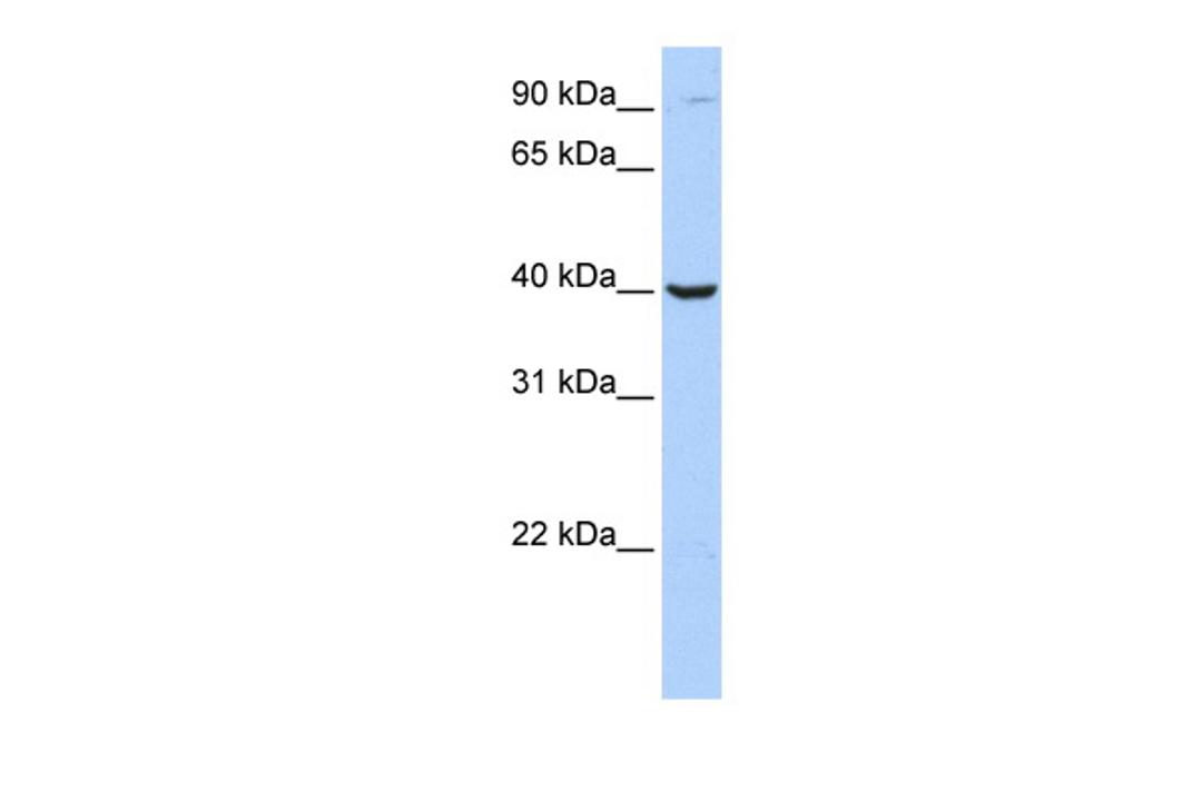 Antibody used in WB on Human Jurkat 0.2-1 ug/ml.