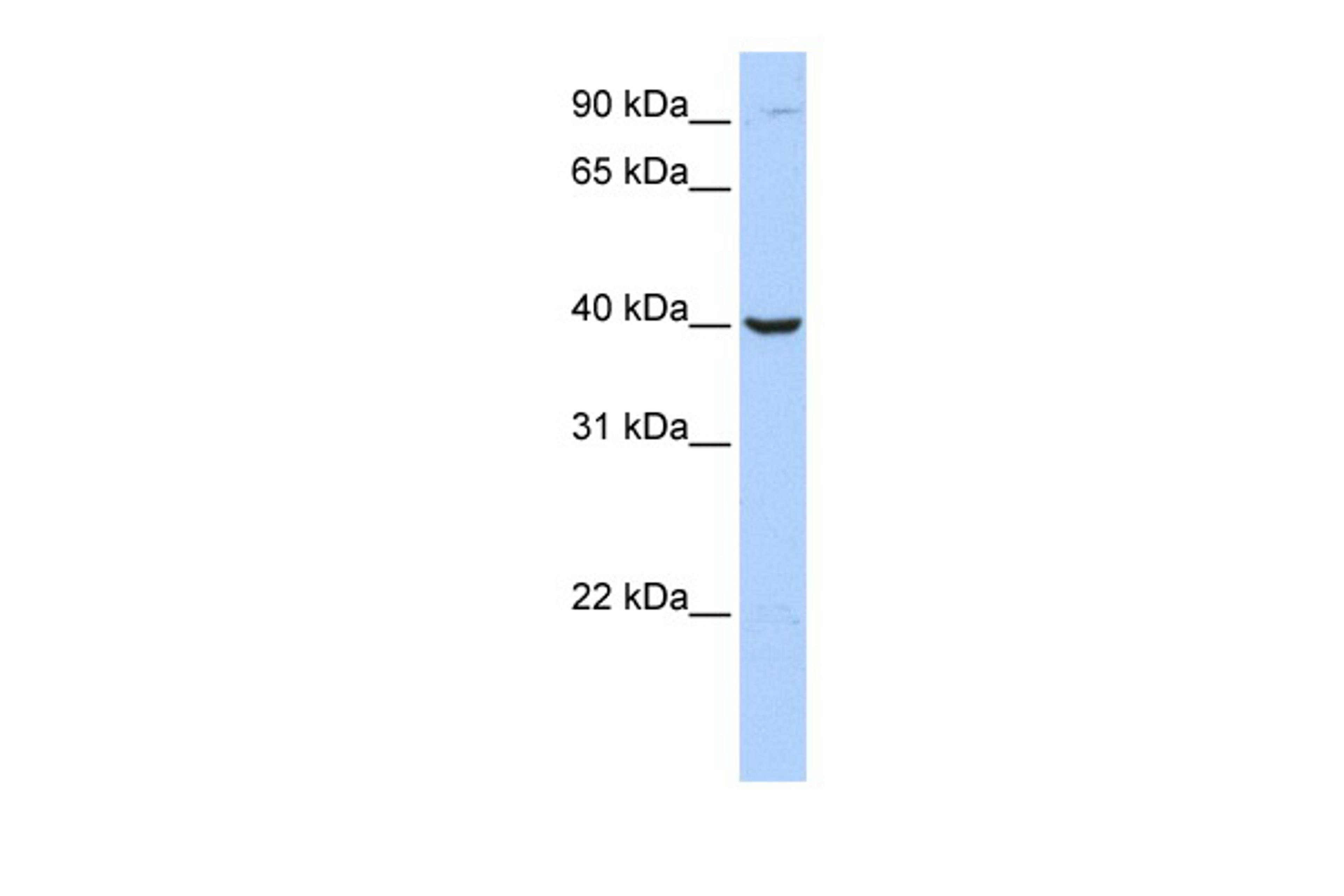 Antibody used in WB on Human Jurkat 0.2-1 ug/ml.