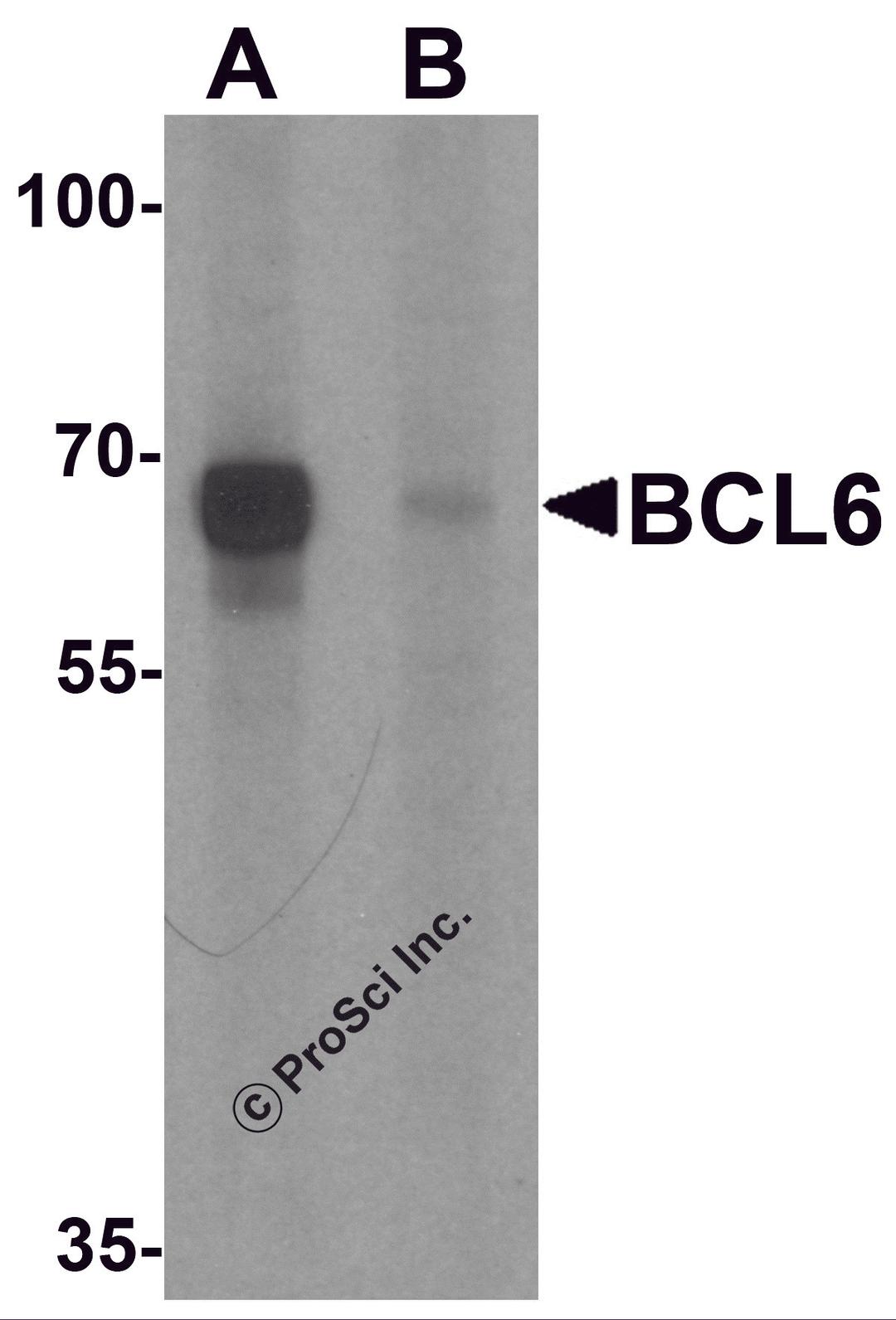 Western blot analysis of BCL6 in rat lung tissue lysate with Bcl6 antibody at 1 μg/ml in (A) the absence and (B) the presence of blocking peptide