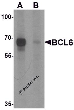 Western blot analysis of BCL6 in rat lung tissue lysate with Bcl6 antibody at 1 μg/ml in (A) the absence and (B) the presence of blocking peptide