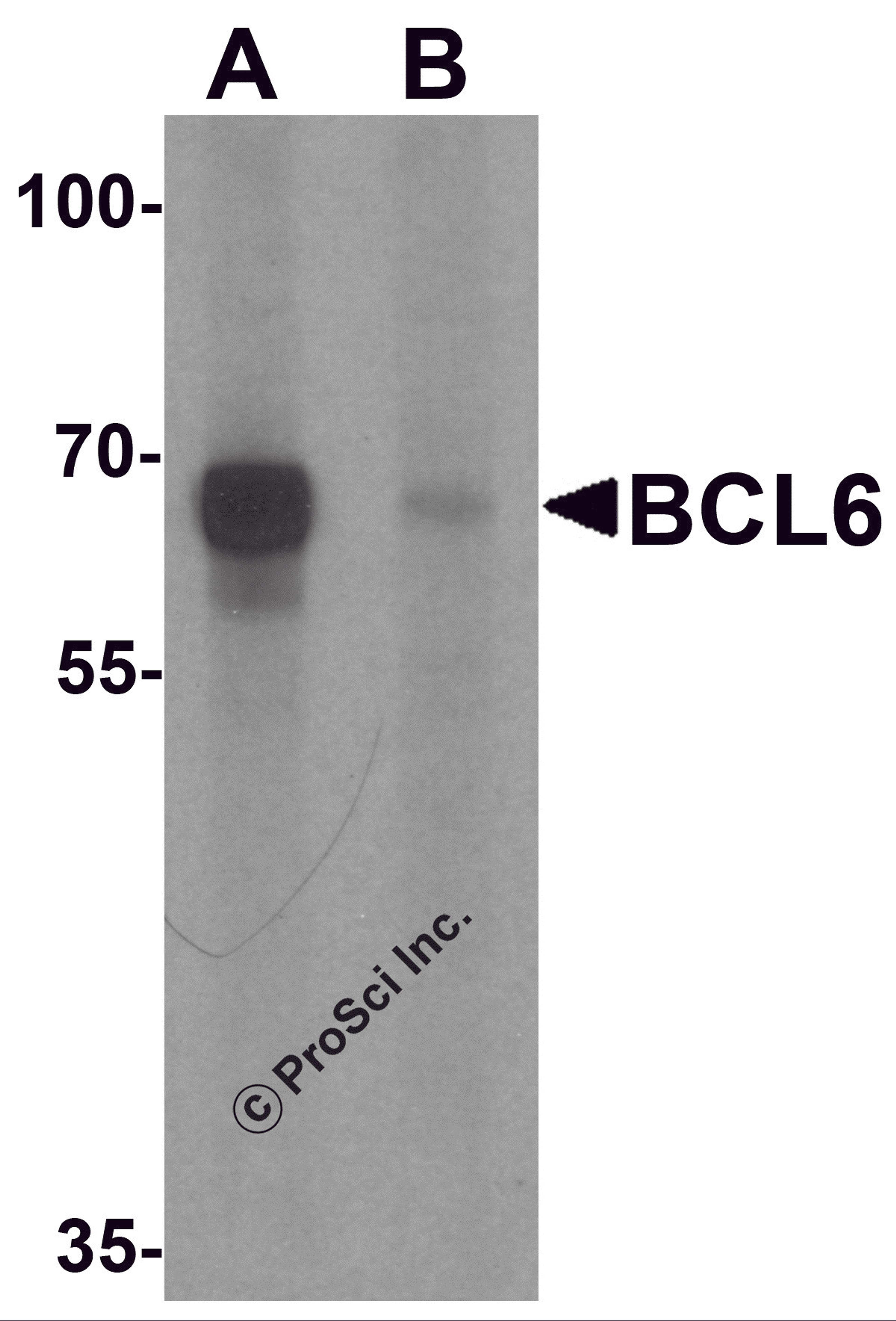 Western blot analysis of BCL6 in rat lung tissue lysate with Bcl6 antibody at 1 μg/ml in (A) the absence and (B) the presence of blocking peptide