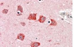 Immunohistochemistry-Paraffin: DKK3 Antibody [NB100-899] - (5ug/ml) staining of paraffin embedded Human Cortex. Steamed antigen retrieval with citrate buffer pH 6, AP-staining.