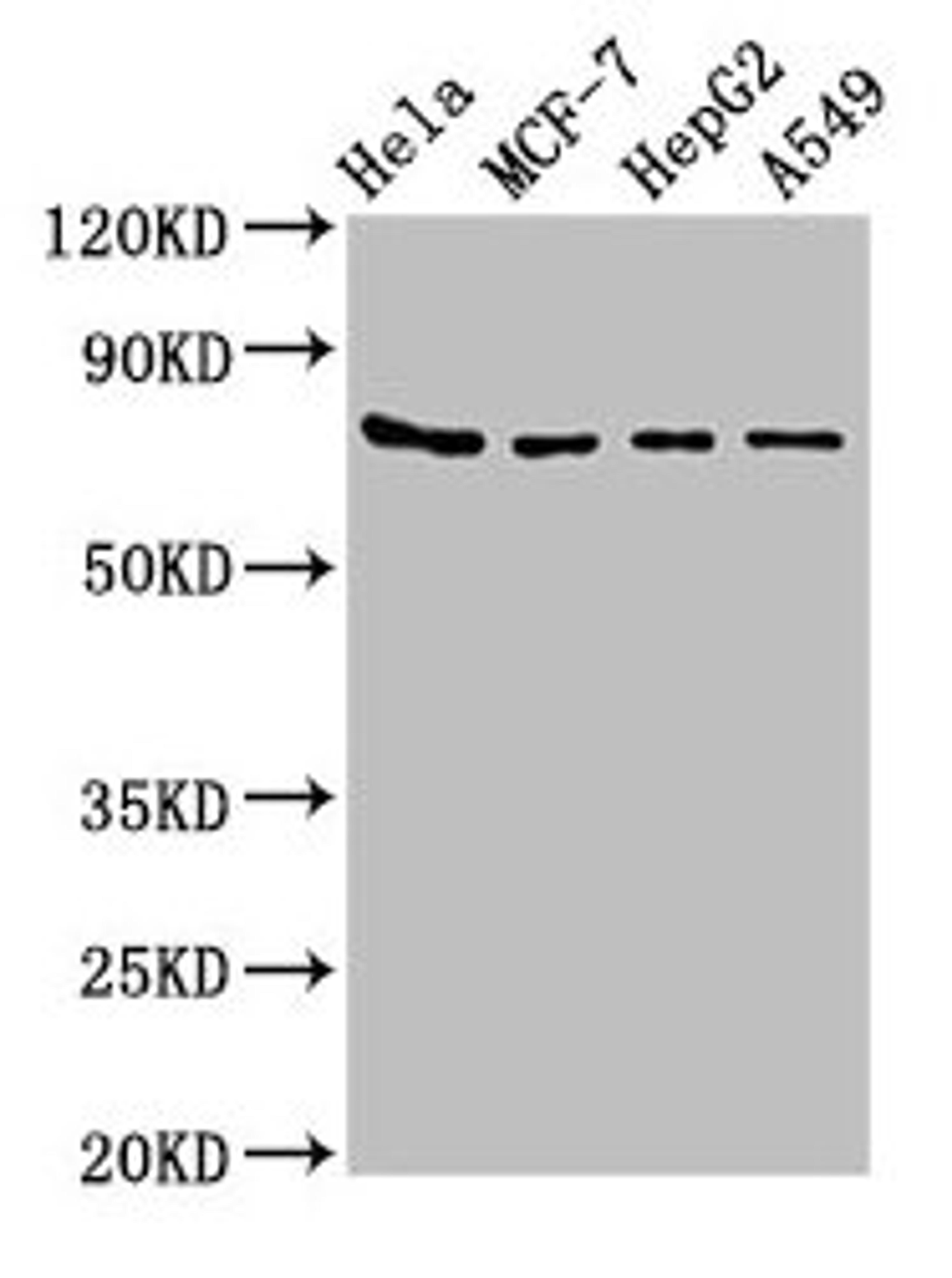 Western Blot. Positive WB detected in: Hela whole cell lysate, MCF-7 whole cell lysate, HepG2 whole cell lysate, A549 whole cell lysate. All lanes: HSPA5 antibody at 4µg/ml. Secondary. Goat polyclonal to rabbit IgG at 1/50000 dilution. Predicted band size: 73 kDa. Observed band size: 73 kDa