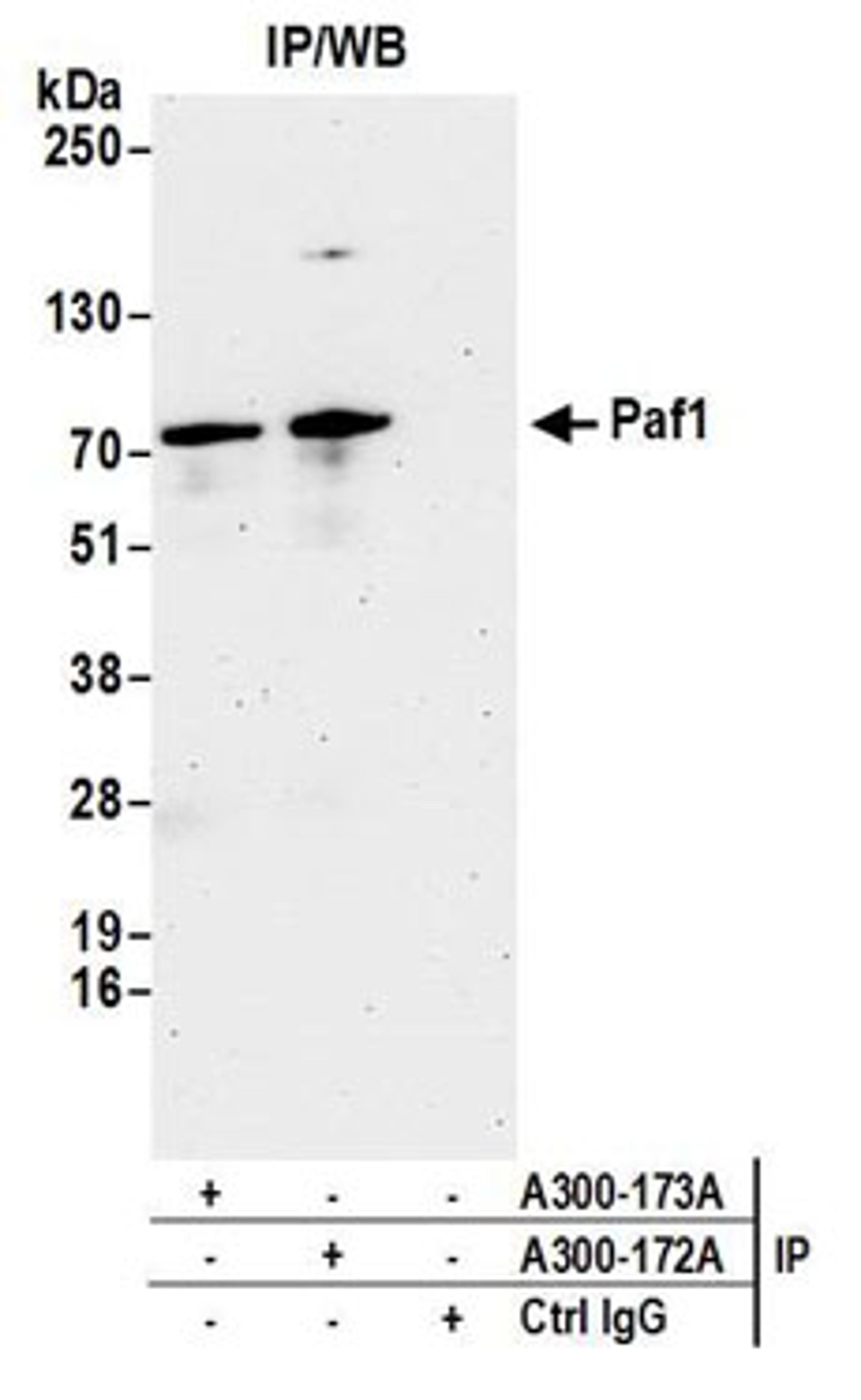 Detection of human Paf1 by western blot of immunoprecipitates.