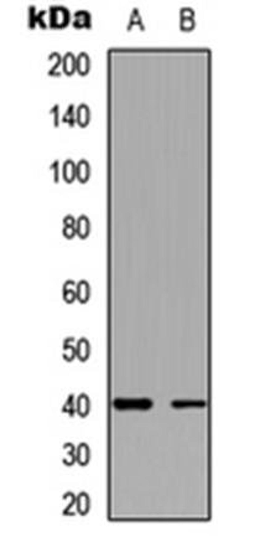 Western blot analysis of HeLa (Lane1), A431 (Lane2) whole cell using TWIK1 antibody