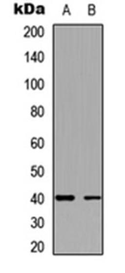 Western blot analysis of HeLa (Lane1), A431 (Lane2) whole cell using TWIK1 antibody