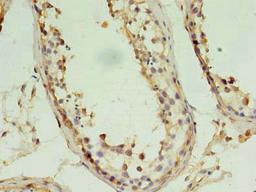 Immunohistochemistry of paraffin-embedded human testis tissue using CSB-PA04619A0Rb at dilution of 1:100
