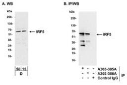 Detection of mouse IRF5 by western blot and immunoprecipitation.