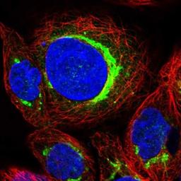 Immunocytochemistry/Immunofluorescence: YIPF2 Antibody [NBP1-90458] - Staining of human cell line A-431 shows positivity in mitochondria & golgi apparatus.