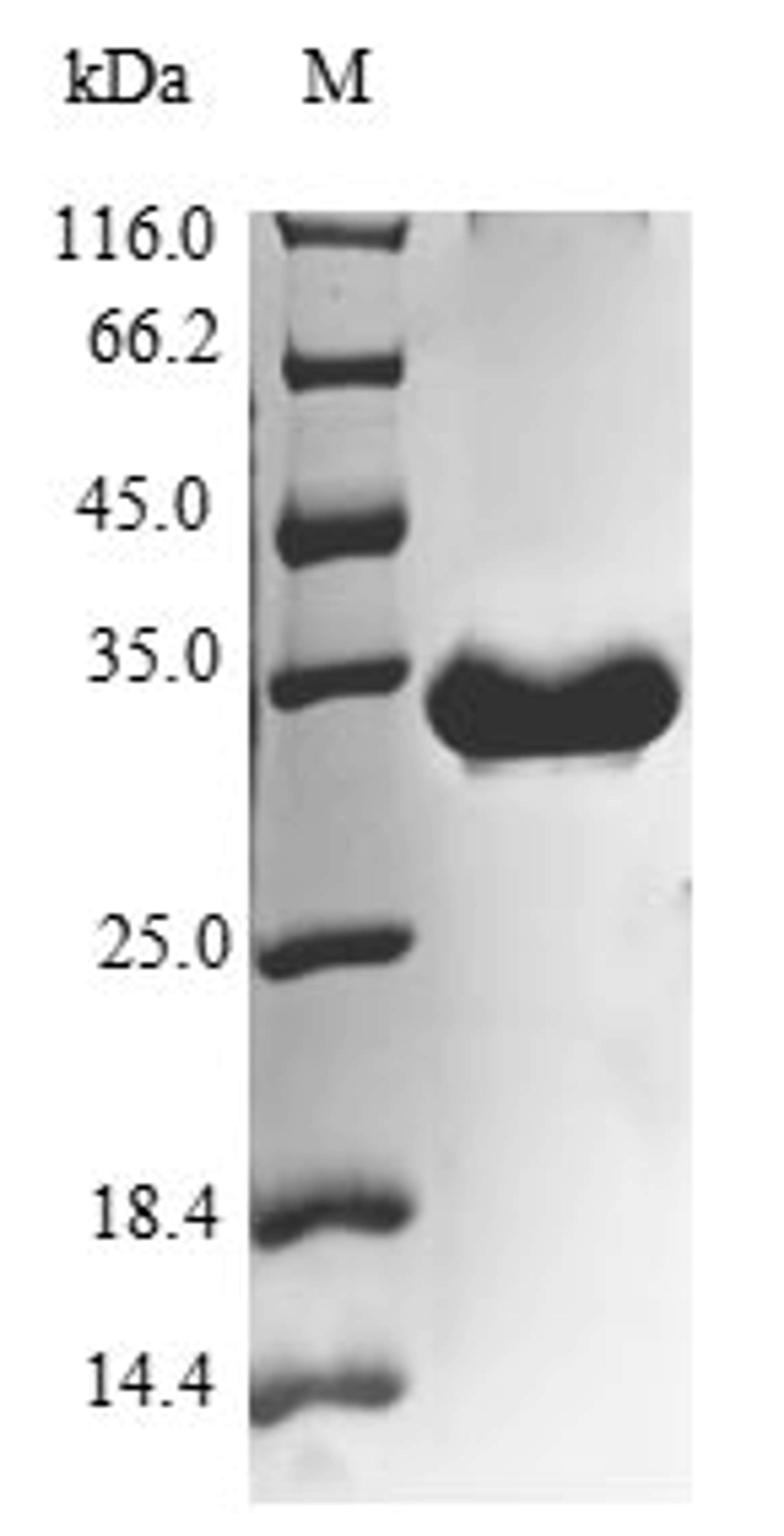 (Tris-Glycine gel) Discontinuous SDS-PAGE (reduced) with 5% enrichment gel and 15% separation gel.