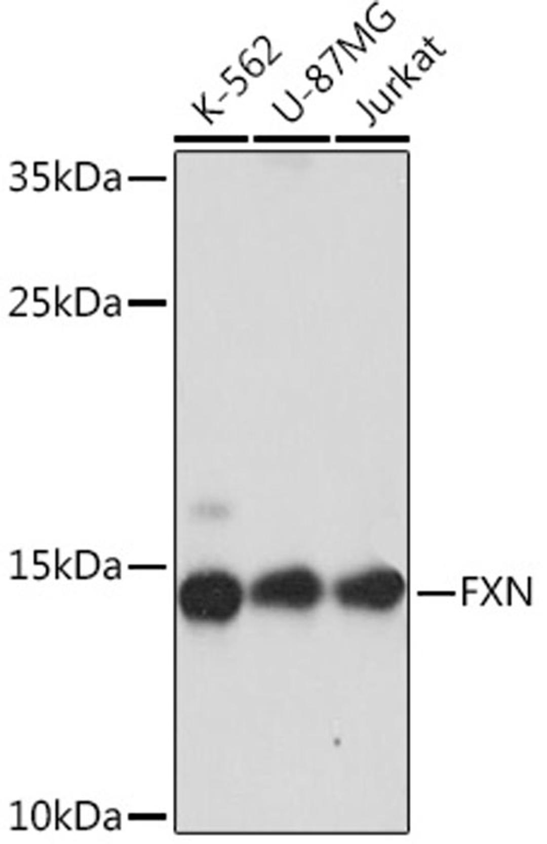 Western blot - FXN Rabbit pAb (A16853)