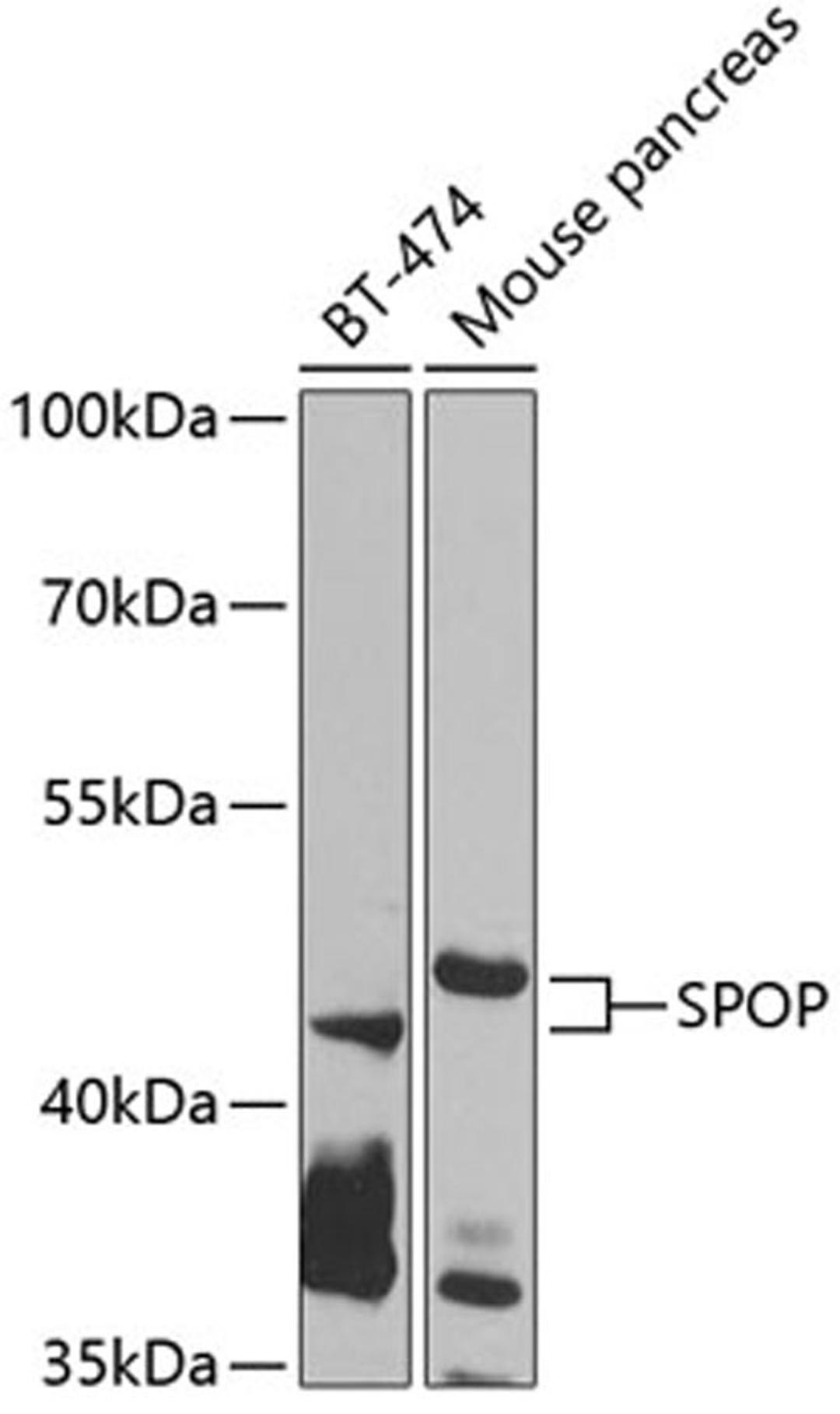 Western blot - SPOP antibody (A7621)